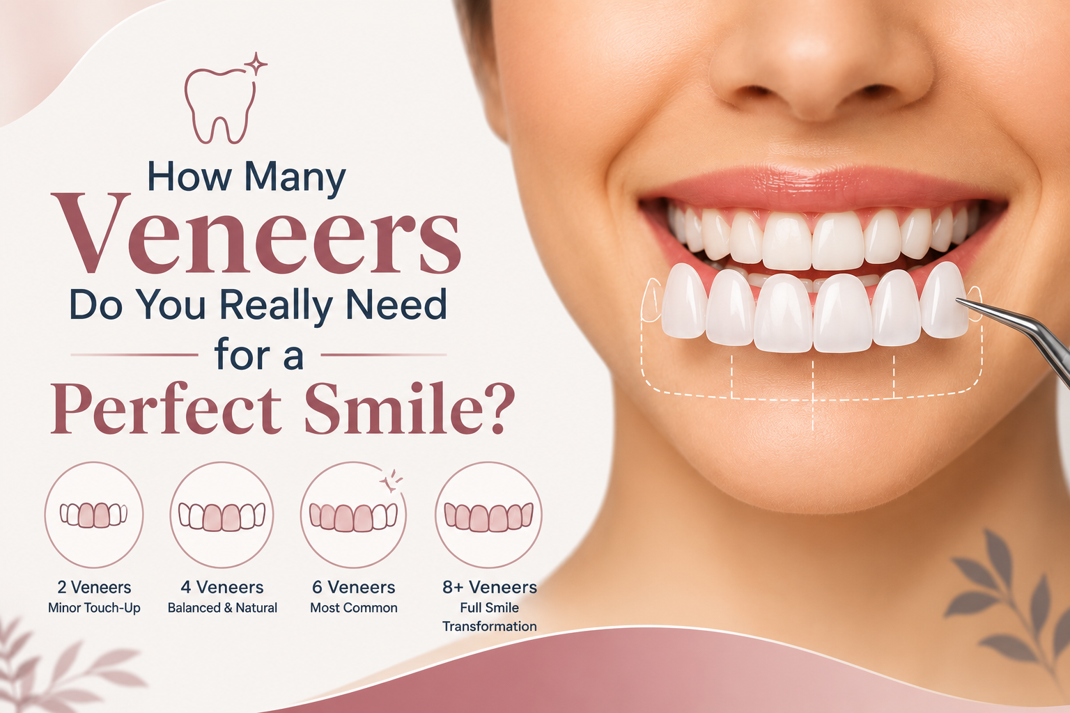 How Many Veneers Do You Really Need for a Perfect Smile?