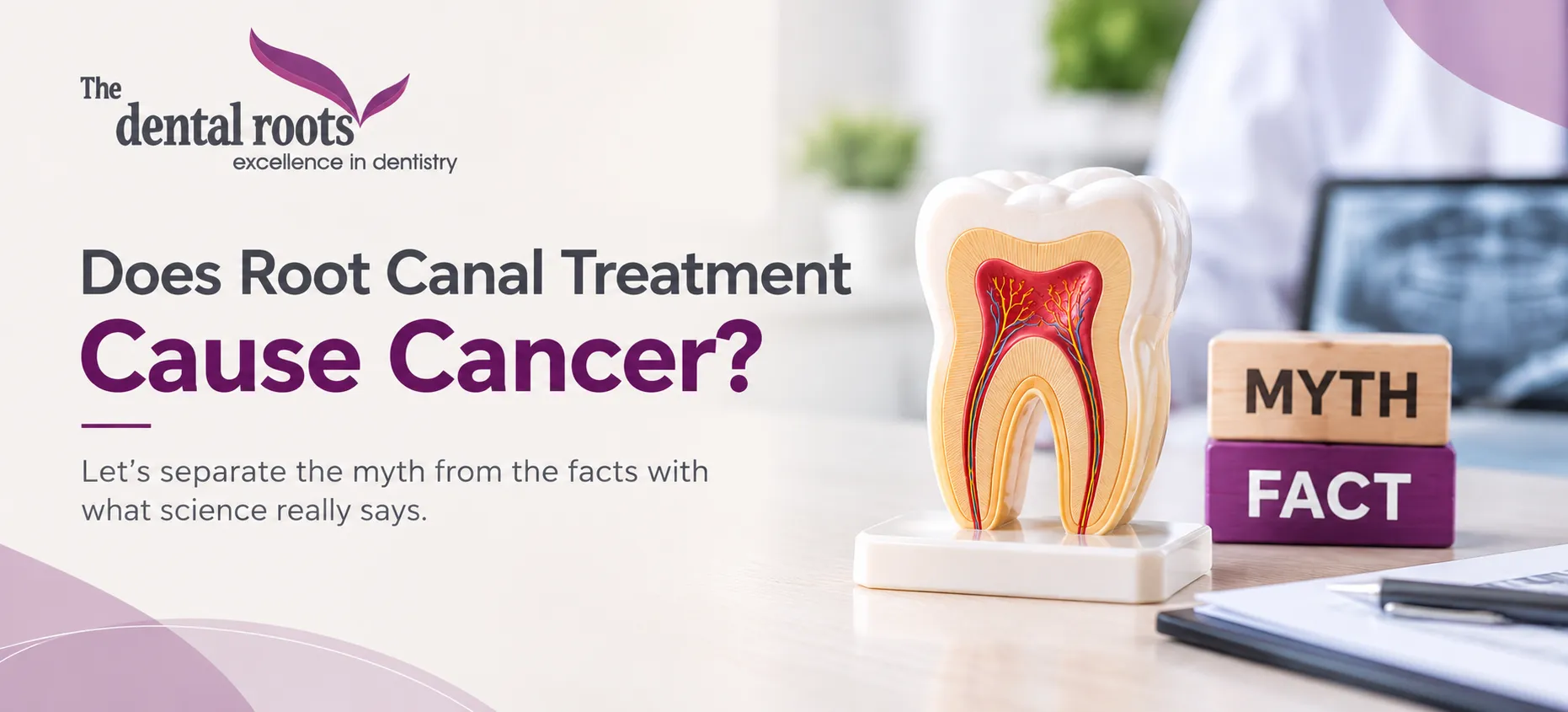 Can Root Canal Treatment Cause Cancer? What Does the Evidence Say?